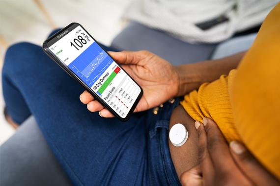 A person sitting down reading numbers from a glucose monitor on a phone. She has a small, round biosensor on her stomach